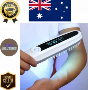 311NM UVB Narrow Band Light β UV Treatment for Vitiligo, Psoriasis, Eczema Thera - Picture 1 of 20