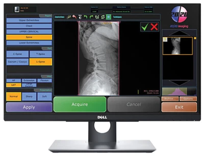 wireless DR panel digital konica Minolta - Image 1 of 3