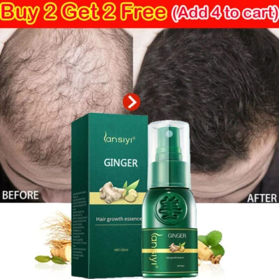 LANSIYI Hair Growth Spray, Grow Hair Fast, Hair Loss Treatment Serum for Men & Women