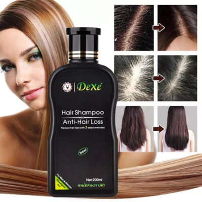 Anti Hair Loss Shampoo Natural Herbal Hair Growth Shampoo for Men & Women 200ml - Image 1 of 4