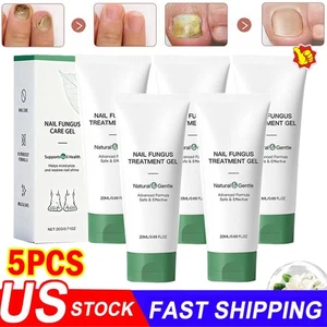 5x Nutraboost Nail Fungus Treatment Gel, Nail Fungus, Fungus Cream US - Picture 1 of 24