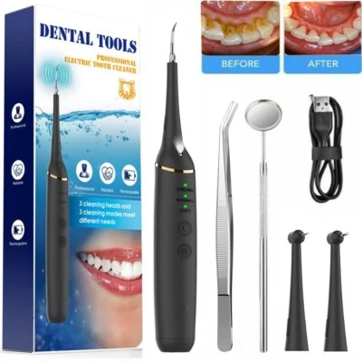 Tooth Cleaner Electric Dental Scaler Tartar Calculus Remover Teeth Cleaning Tool
