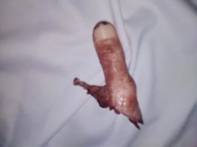 Silicone horror movie prop severed thumb chopped off gore prank film halloween  - Image 1 of 3