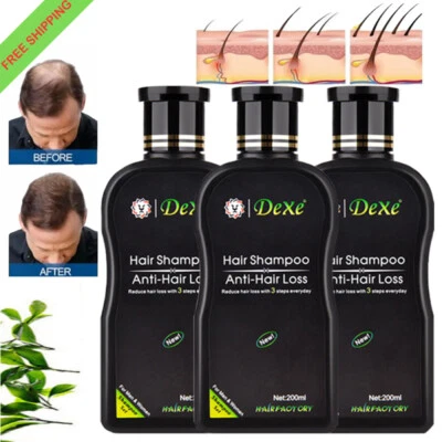 3/2x Anti Hair Loss Shampoo Women Men Herbal Hair Growth Treatment Hair Regrowth - Image 1 of 4