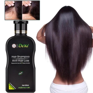 200ml Dexe Original Anti Hair Loss Shampoo Natural Herbal Hair Growth Treatment - Picture 1 of 14