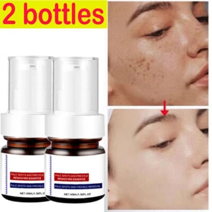 2X Anti Spot Serum, Freckle Removing Essence, Vitamin C Freckle Cream 40ml  - Picture 1 of 12