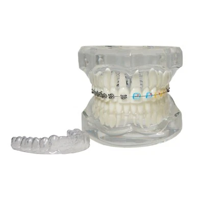 Dental Teeth Model Orthodontic With Retainer Metal Ceramic Bracket M3012 Clear - Image 1 of 4