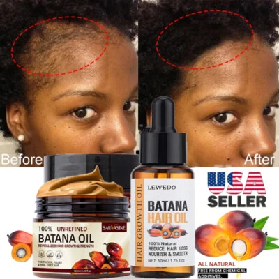 Acondicionador de aceite de batana para el crecimiento del cabello más saludable más grueso más lleno anti pérdida de cabello Foto 1 de 4