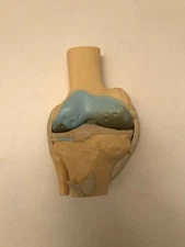 Arthritic Knee Medical Desk Model
