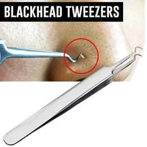 UK Blackhead Acne Extractor Tool Curved Tweezer Stainless Steel Remover - Picture 1 of 17