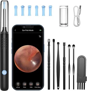 Wohlmen Ear Wax Removal with HD Camera Wireless Compatibility with Iphone, Ea... - Picture 1 of 9