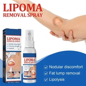 1/2/3 Stück Lipomheilung Reduktion Spray, sofortige klumpenfreie Lipomentfernung X6O8 - Bild 1 von 18