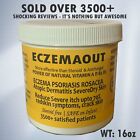 Crème de traitement intense pour l'eczéma psoriasis rosacée acné dermatite éruption cutanée 16 oz