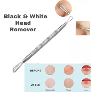 Professional BLACKHEAD WHITEHEAD EXTRACTOR Pimple Popper Acne Remover Tool UK - Picture 1 of 5