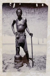 170f. RPPC, BLACK MAN W/ EXTREME MEDICAL CONDITION IN 1 LEG, ELEPHANTIASIS? - Picture 1 of 2