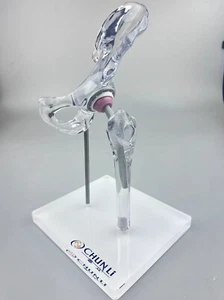Reemplazo Articular Cadera Artificial Transparente 1/3 Modelo Demostración Médico Anatómico - Imagen 1 de 9