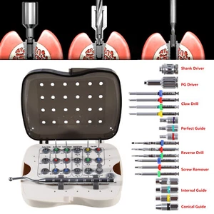 Schraubenentfernung Universal Zahnimplantat Fraktur Neobiotech SR Reparatur Werkzeug Kit - Bild 1 von 21
