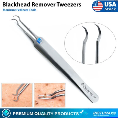 INSTUMAX® Curved Tweezers Blackhead Remover Pimple Extractor Popper Acne Blemish Comedone