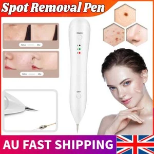 Laser Freckle Removal Machine Skin Mole Dark Spot Face Wart Tag Remover Pen AU - Picture 1 of 12