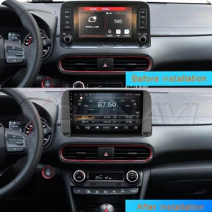 10.1Inch Androind 10.0 Car GPS Navi for Hyundai Kona Encino 2018-2021 Stereo 4G - Picture 1 of 12