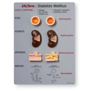 Kit de Enseñanza Vida/Forma Diabetes Mellitus NUEVO Placa Nasco WA20495 9x12 - Imagen 1 de 4