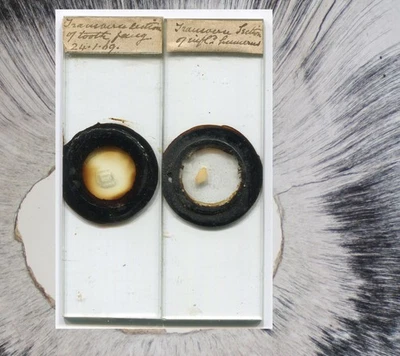 Diapositivas de microscopio de dientes y huesos 1869 Foto 1 de 4