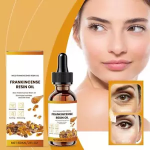 Organic Frankincense Resin Facial Oil - Reduces Fine 60ml Lines US V8S9 - Picture 1 of 21
