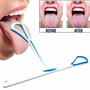 Plastic Tongue Scraper Cleaner Bad Breath Hygienic Oral Mouth Cleaning Tool UK - Picture 1 of 10