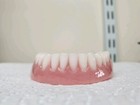 Zahnprothese,zahnersatz,prothese,niedriger dental,Gebiss,dentures,False teeth