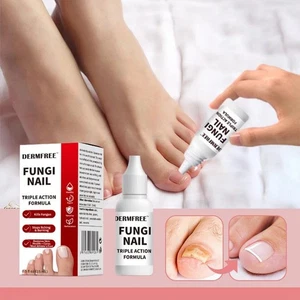 Tratamiento de uñas hongos de 15 ml - Fórmula de triple acción, mata hongos, antihongos en las uñas - Imagen 1 de 12