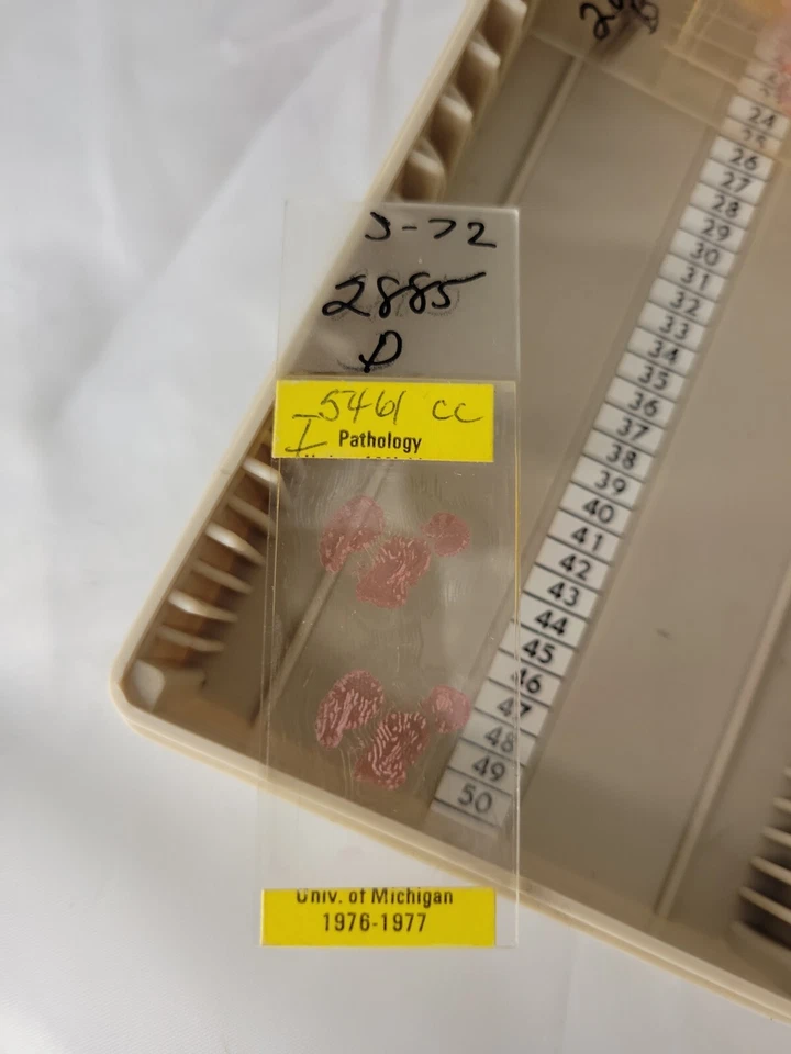 1976-77 Pathology Neoplasm University of Michigan Microscope Slides - Image 1 of 4