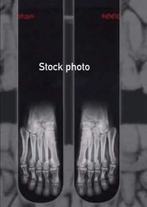 Darby Allin Hoodlum Socks Broken Foot X-Ray AEW Wrestling New Sealed - Picture 1 of 3