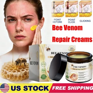 Bee Venom Repair Creams, 2025 Professional Formula For Skin Treatment HOT SALE - Picture 1 of 23