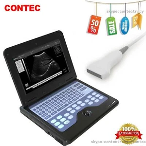 CONTEC Digitale Laptop-Scanner-Maschine Ultraschalldiagnose+7.5Lineare Sonde,CE - Picture 1 of 16