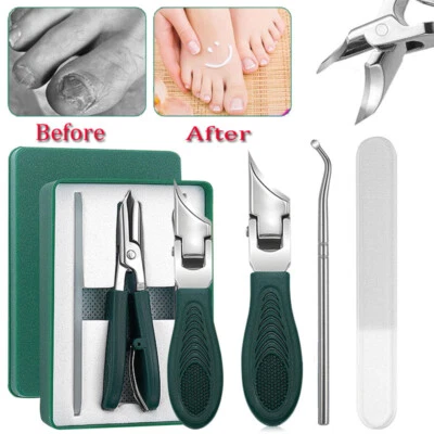 Cortaúñas de pico de águila, cortaúñas biseladas de pico de águila, juegos de águila de lujo Foto 1 de 4