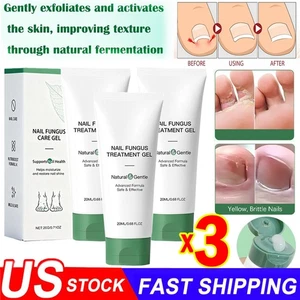 Nutraboost Nail Fungus Treatment Gel, Nail Fungus, Fungus Cream 2025 NEW - Picture 1 of 22