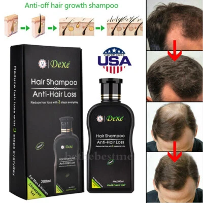 200ml Regeneration Regrowth Hair Growth Shampoo Natural Anti Hair Loss Treatment - Image 1 of 4