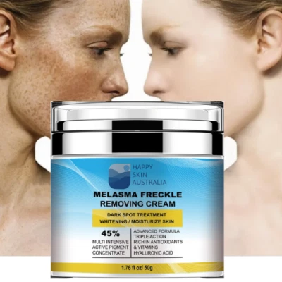 Freckles,Melasma Skin Whitening Cream Improve Skin Spots & Uneven Skin Tone 50g - Image 1 of 4