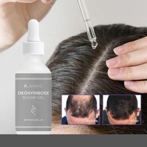Ginger & Cypress Leaf Essential Oil Hair Loss Prevention 60ml V8K2 - Picture 1 of 12