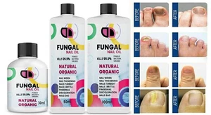 Solución líquida eficaz para reparación de uñas de dedo del pie y hongos tratamiento antimicótico Reino Unido - Imagen 1 de 4