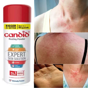 Candid Dusting Powder Expert Solution For All type of Skin Problem - 60 Gm - Bild 1 von 9
