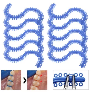 Separadores moldeados por corbata separada de ortodoncia dental cadena eléctrica dentista azul - Imagen 1 de 15