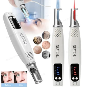 Professional Laser Picosecond Pen Blue&Red Tattoo Remover Acne Mole Scar Cleaner - Picture 1 of 24