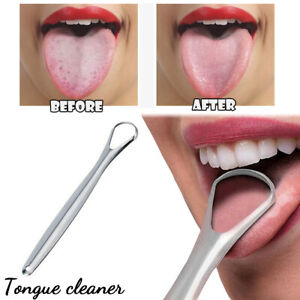 Stainless Steel Tongue Tounge Cleaner Scraper Dental Care Oral Hygiene Mouth Kit