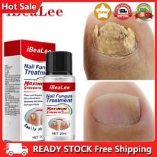 20ml Nail Repair Fluid Anti Infection Paronychia Essence Effective for Foot Care