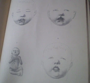 E.-F. BOUISSON: TUMEURS/CANCER BUCCAL/PÉNIS/HYPOSTADIAS// LAUTREAMONT: Maldoror - Picture 1 of 5