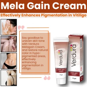 Mela Gain VITILIGO HAUTFARBE WIEDERHERSTELLUNGSCREME VITILIGO BEHANDLUNG WEISSE FLECKEN - Bild 1 von 8