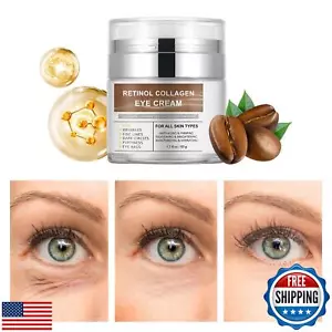 Retinol Eye Cream for Dark Circles and Puffiness Bags, Caffeine Eye Creams wi - Picture 1 of 5