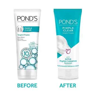 PONDS Face Wash Pickel Klarschaum Gesichtswasser 100 Gramm - Bild 1 von 8