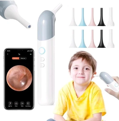 Otoscope Ear/Nose/Mouth Camera 1080P WiFi with 6 Lights Ear Scope Android/iPhone - Image 1 of 4